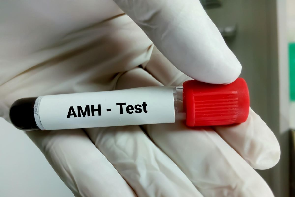 AMH-Test