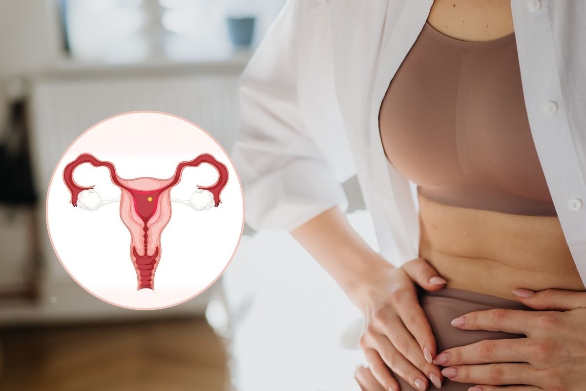 Adenomyosis-Treatment