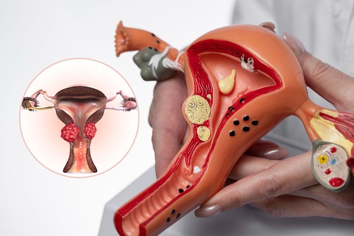 Cervical-Cancer-Screening