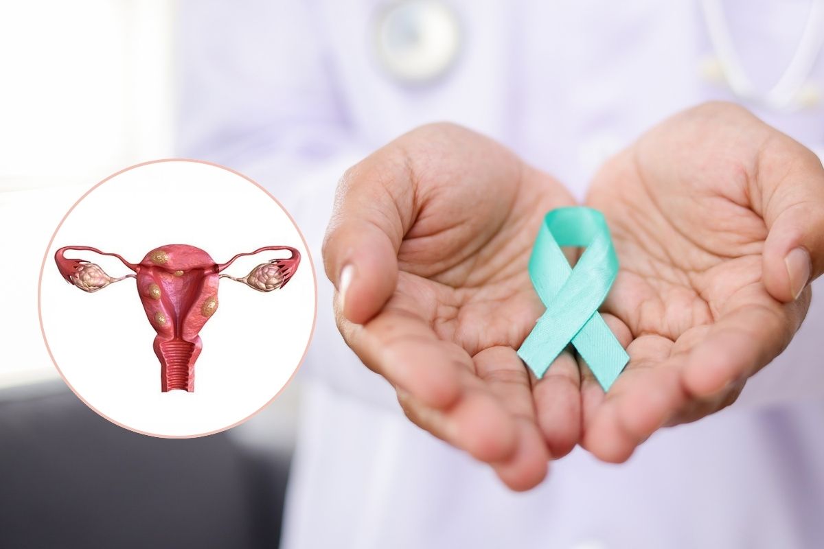 Fibroid-Treatment