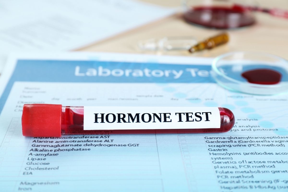 Hormonal-Testing